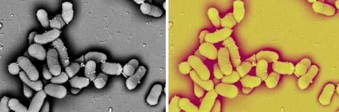 Грамотрицательные бактерии: характеристика и роль в микробиологии