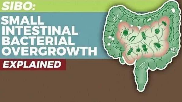 Причины синдрома избыточного бактериального роста