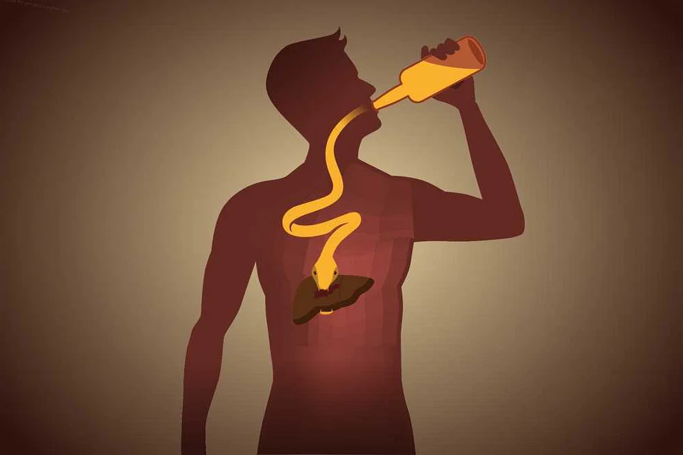 Синдром сухих слизистых оболочек: причины и связь с употреблением алкоголя